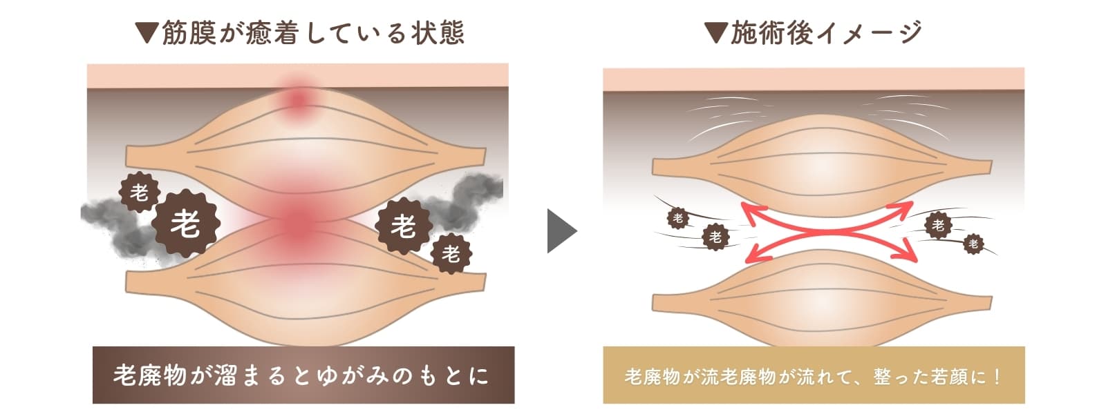 kinmakurihuto_zukai02